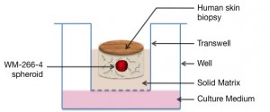 OncoSkin® melanoma skin cancer model using human skin biopsies to study melanoma