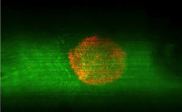 skin cancer spheroid in OncoSkin melanoma skin cancer models