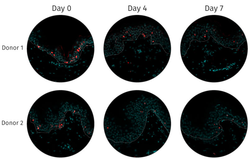 Viability and response NativeSkin human skin models