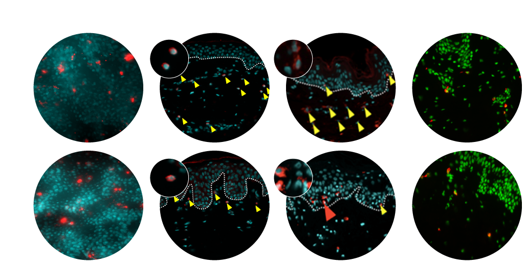 human skin response immunocompetent skin model NativeSkin