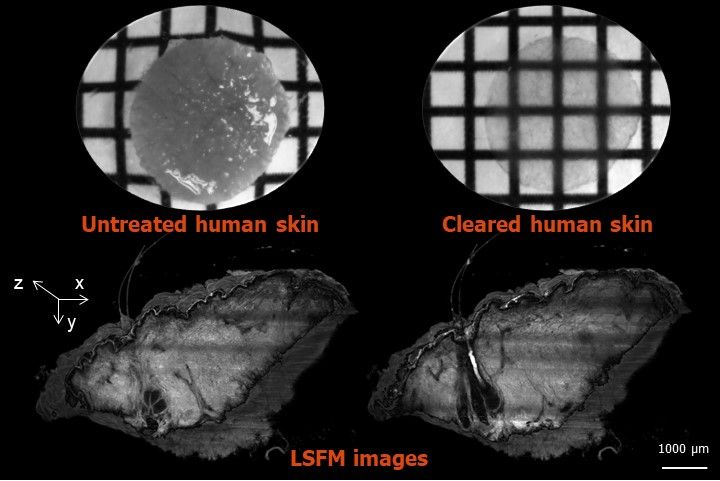 3D imaging skin