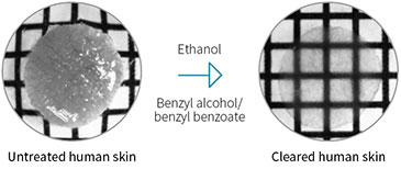 Illustration showing a human skin biopsy before and after optical clearing with ethanol and benzyl alcohol/benzyl benzoate