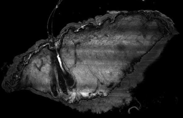 LSFM 3D imaging of a full-thickness skin biopsy