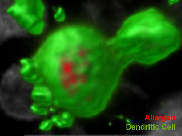 photo of immunostaining using confocal microscopy localizing allergen in langherans cells