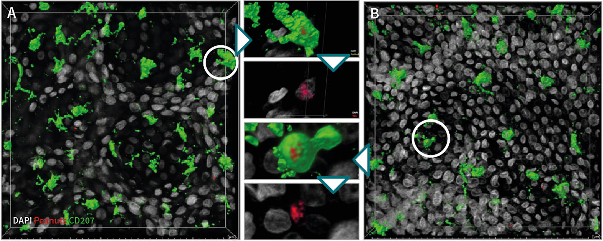 Observation of in situ immunostaining on detached epidermal sheet after 24H of treatment with Viaskin® peanut using confocal microscopy