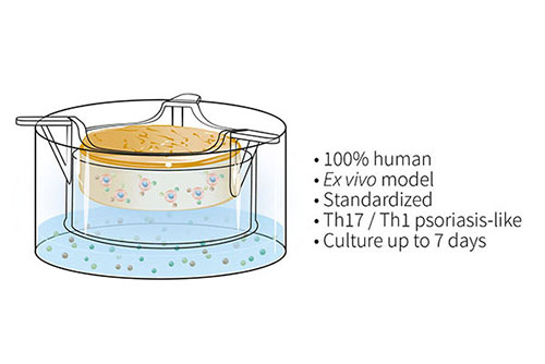 illustration showing Genoskin's InflammaSkin model for publications