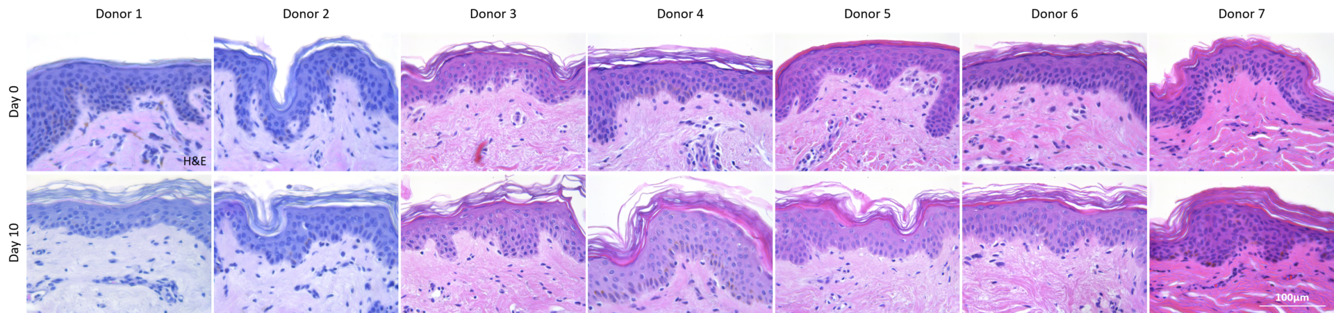 H&E skin integrity