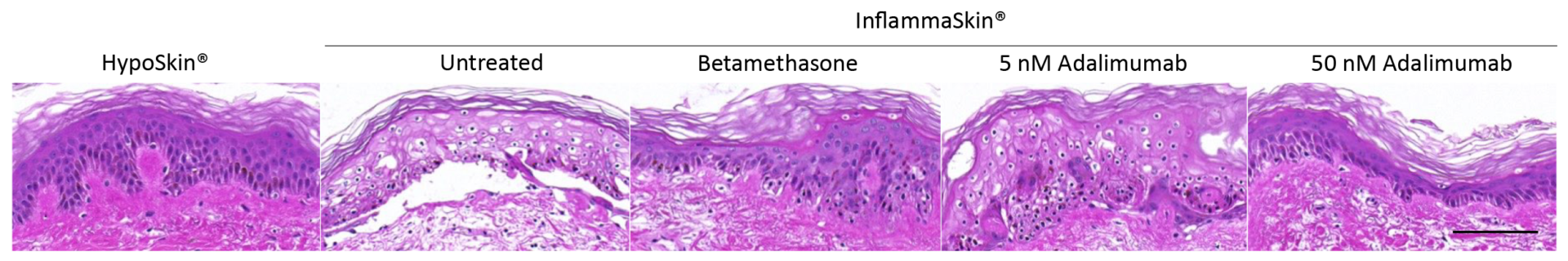 A series of 5 H7E staining photos showing how InflammaSkin® assay responds to the injection of adalimumab