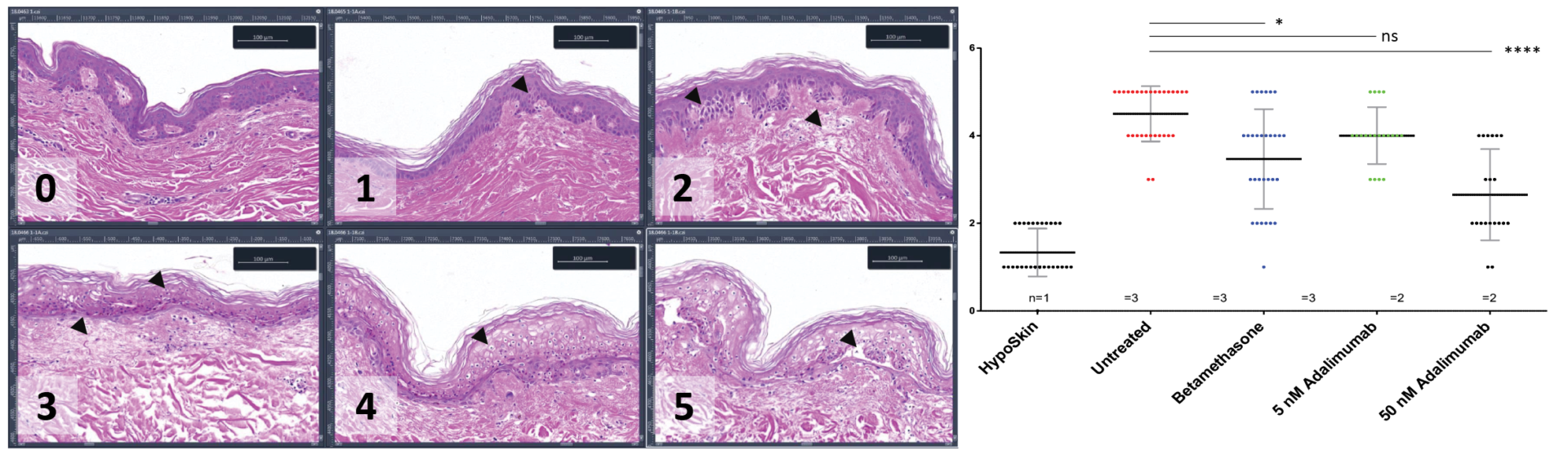 Two graphics showing how InflammaSkin® assay reacts to adalimumab injection