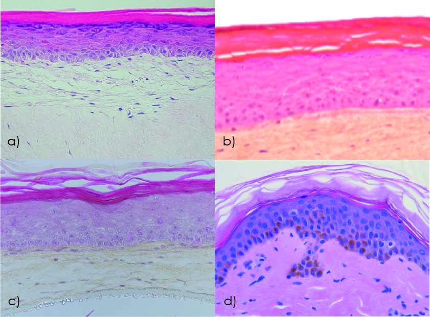 Difference in structure between reconstructed skin and native skin