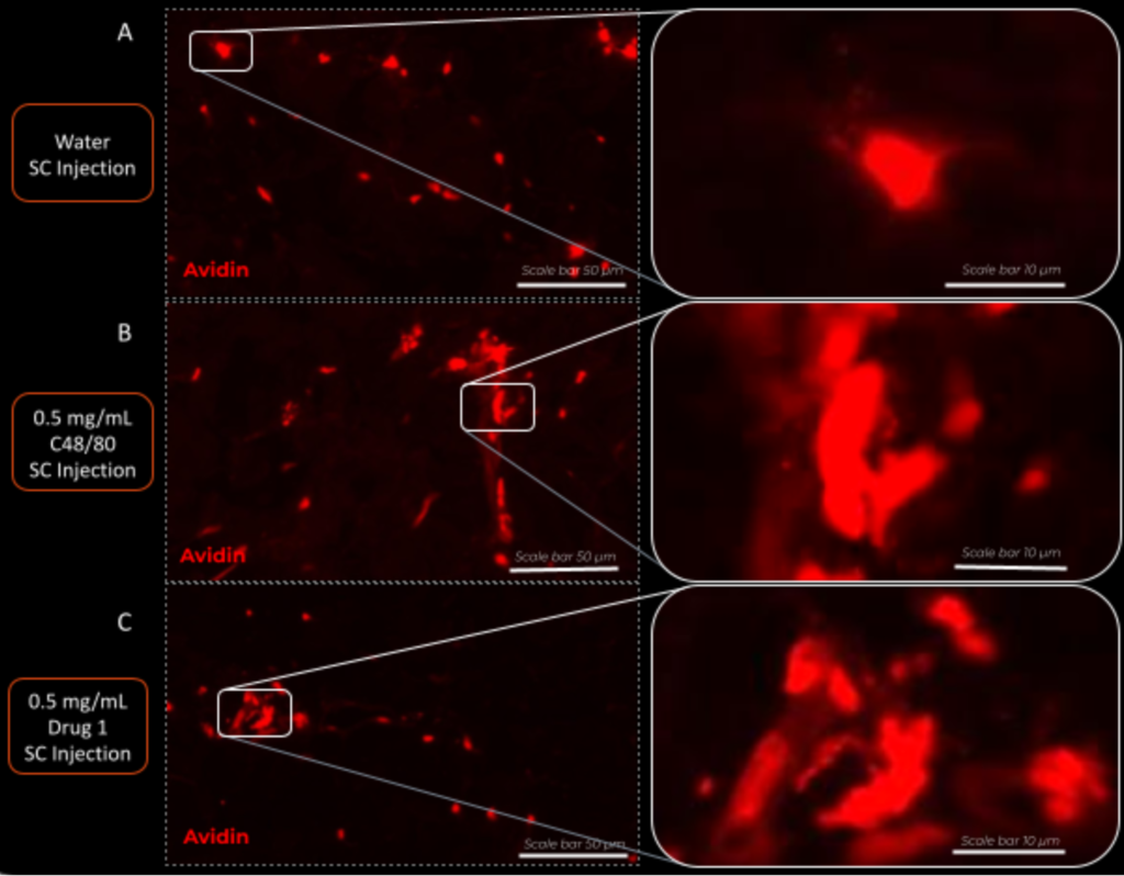 Mast cell granules in injected Hyposkin models