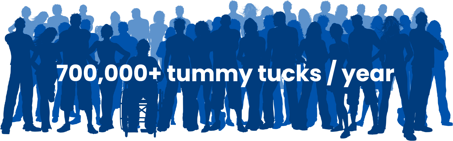 Tummy Tuck Illustration 20220105