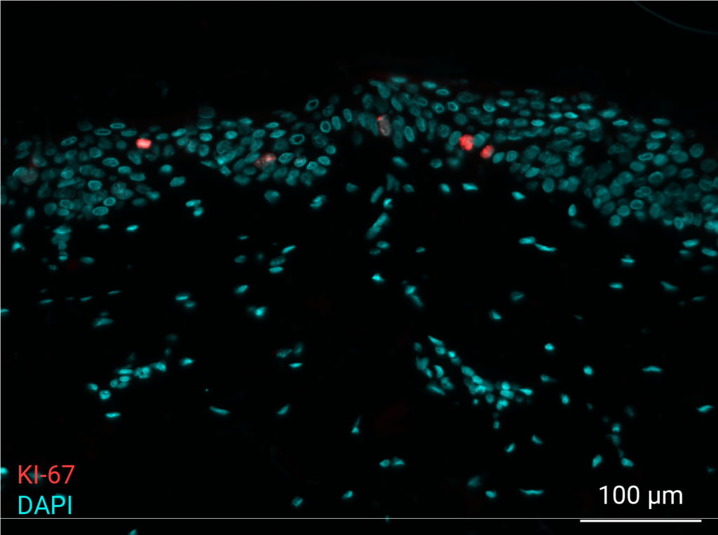 Biologic validation of Nativeskin skin models for cell proliferation