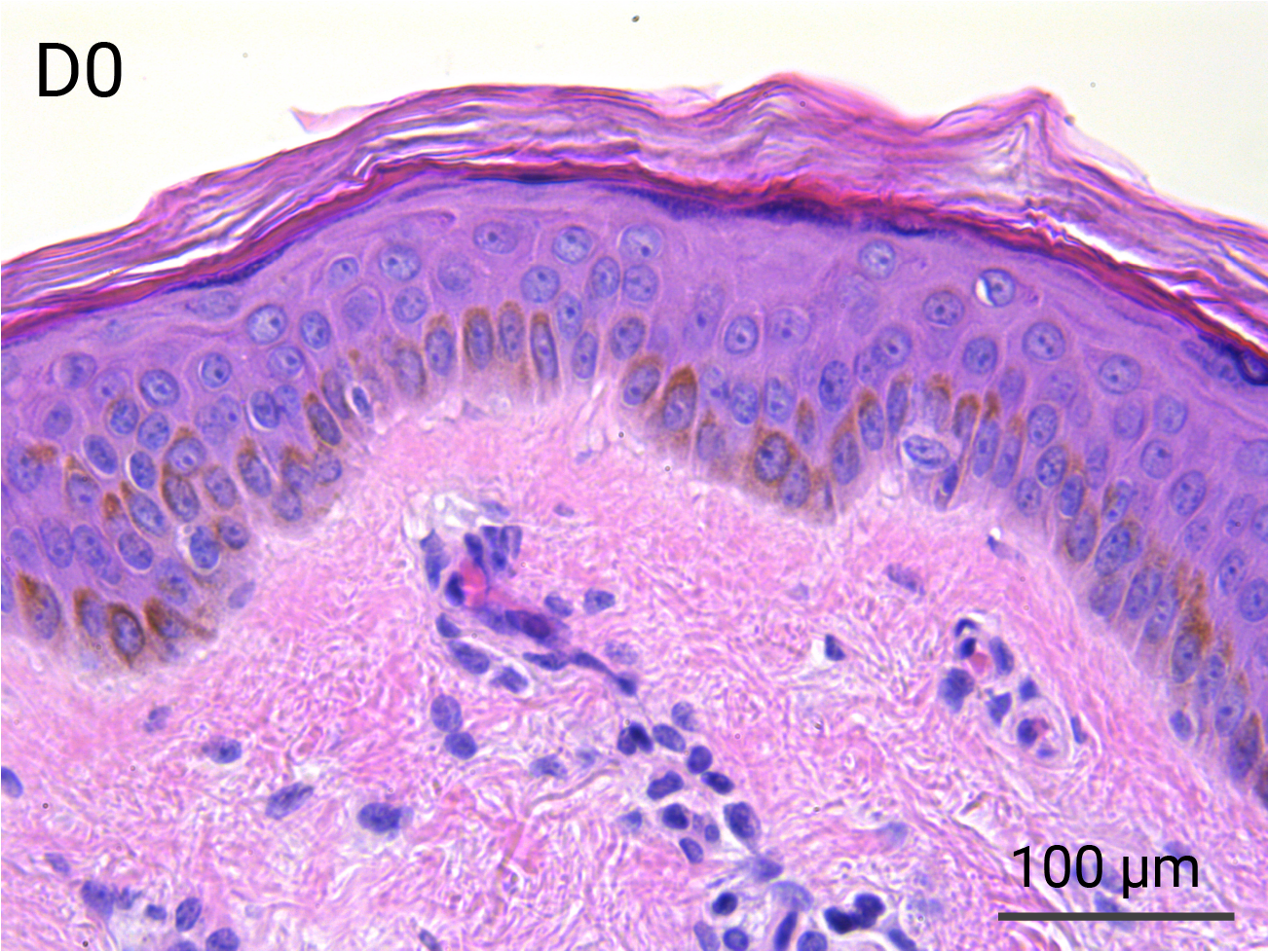 HypoSkin Epidermis & Papillary Dermis - Day 0