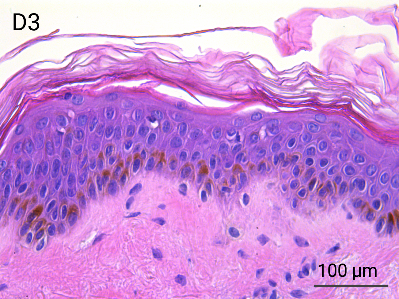 HypoSkin Epidermis & Papillary Dermis - Day 3