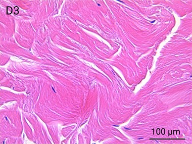 Nativeskin-HE-staining-Dermis-D3