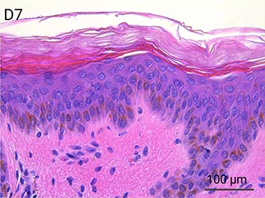 Nativeskin - HE staining - Epidermis D7-04