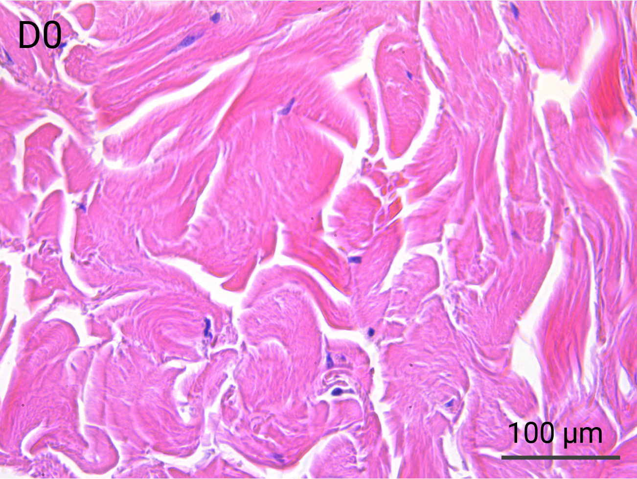 HypoSkin Reticular Dermis - Day 0