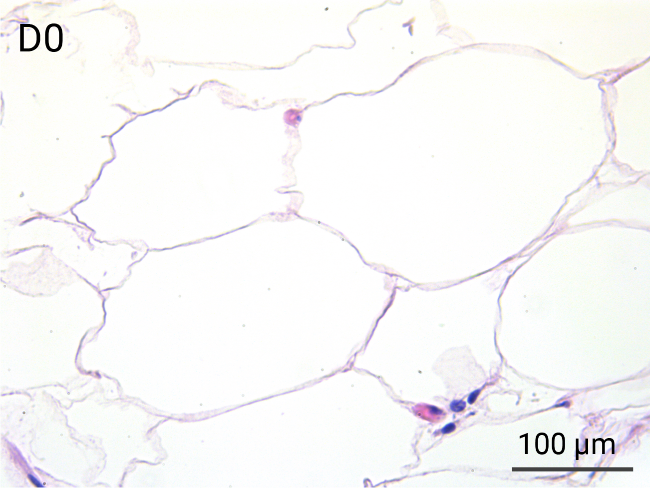 HypoSkin Subcutaneous tissue - Day 0