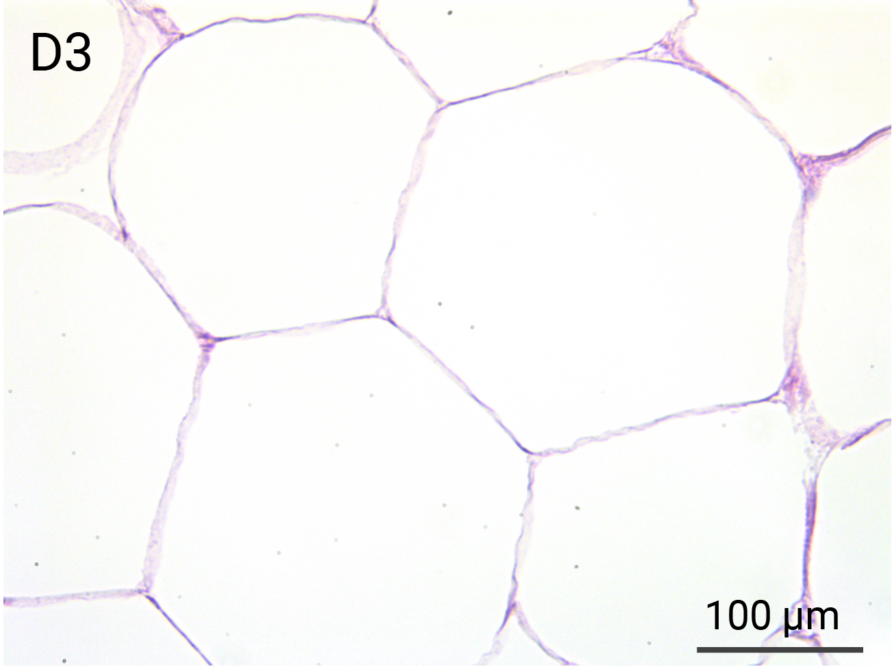 HypoSkin Subcutaneous tissue - Day 3