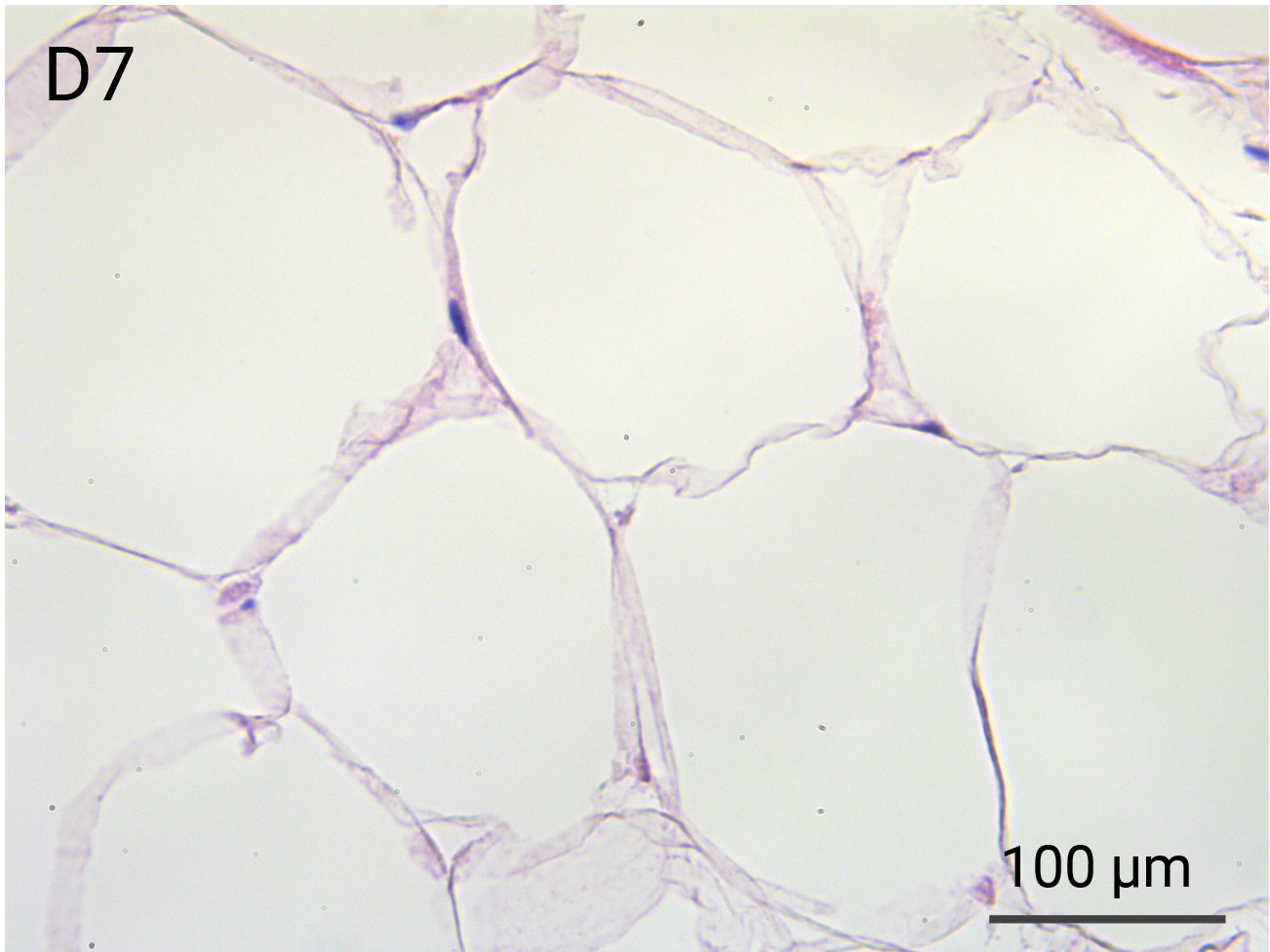 HypoSkin Subcutaneous tissue - Day 7