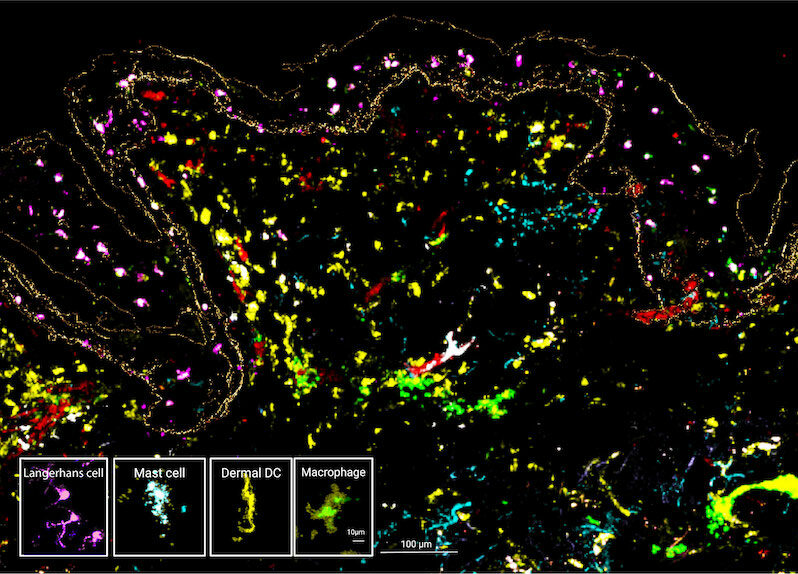 Diversity of myeloid cells in HypoSkin® at D1 of culture. Acquisition made thanks to our proprietary spatial biology solution, MANTIS and using the Myeloid Cells panel