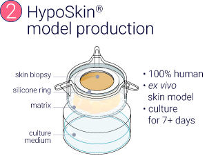 A serie of 4 illustrations showing the production of InflammaSkin® model from resident T cell in situ activation to the therapeutic treatment