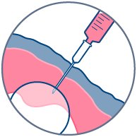 Bolus injection