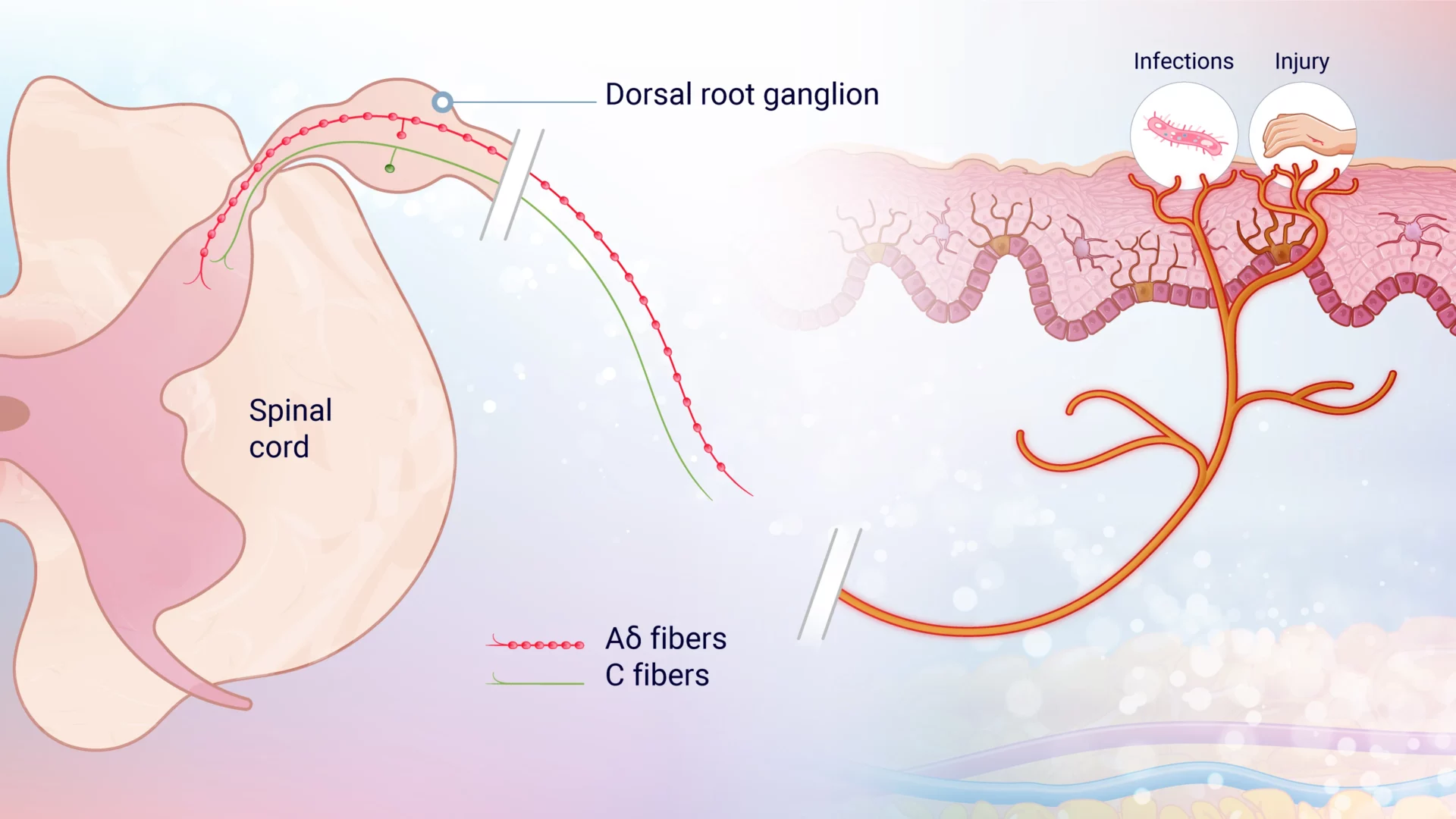 neurogenic inflammation can occur upon subcutaneous injection of a therapeutic molecule. understanding its mechanism allows to refine formula to prevent it