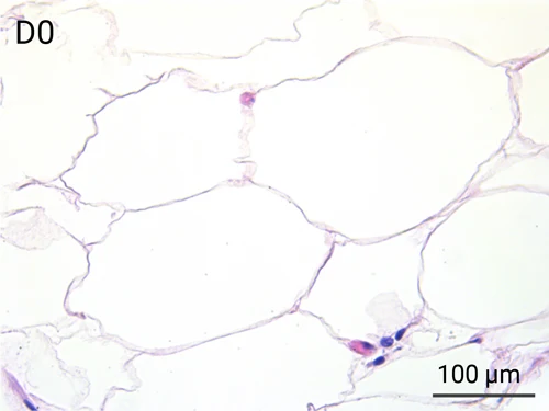 HypoSkin Subcutaneous tissue - Day 0