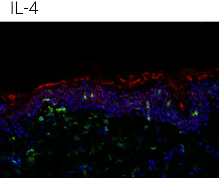 Representative immunohistochemistry images