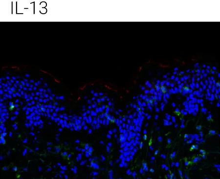 Representative immunohistochemistry images