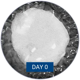 Monitoring of wound closure