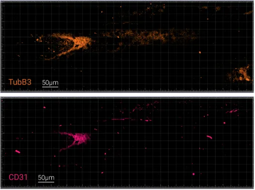 Structural and activation markers analysis performed on a tissue cryosection with a thickness of 40µm: DAPI (nucleus), CD45 (immune cells), Tubulin β3 (nerve endings), CD31 (blood vessels)