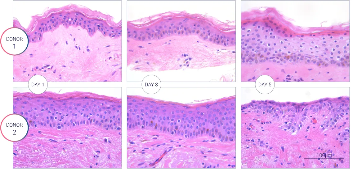 H&E staining showing the hair follicle characterization during the culture. Viability of the hair follicle measured over 3 days for different donors