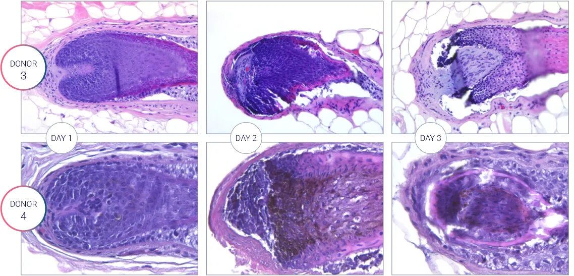 H&E staining showing the hair follicle characterization during the culture. Viability of the hair follicle measured over 3 days for different donors